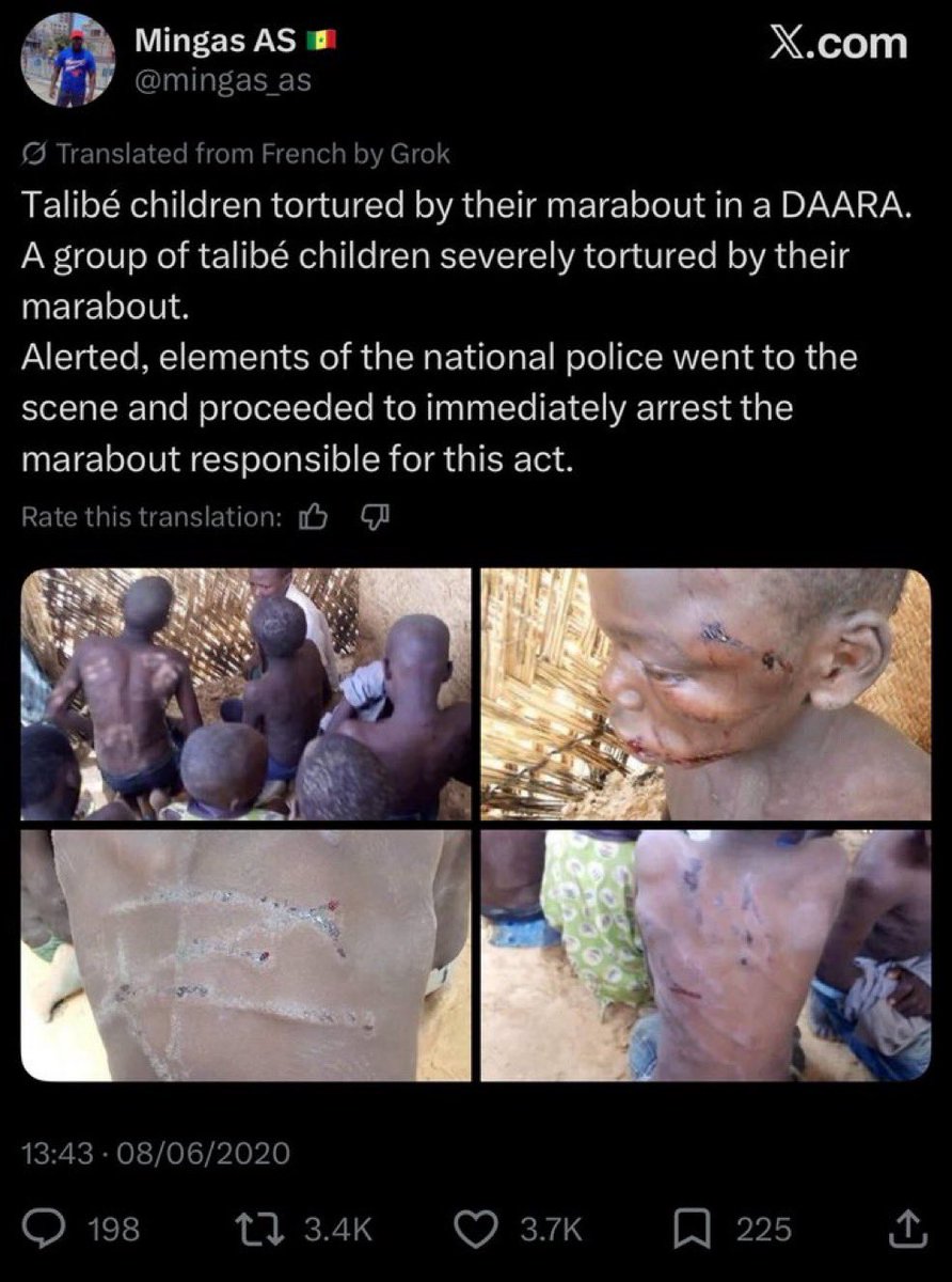 Onsogbu's tweet photo. It was an April 2026 picture of a tortured child by an Igbo man that propagandists started using as Oyo state kidnapped victim then went ahead to use a 2020 (6 years ago) picture for the same propaganda....
 Still continued with the propaganda by using an AI generated image as the students of the school

Shame on all of you.