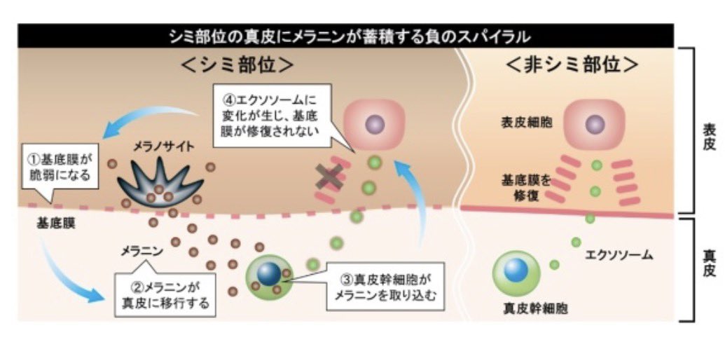 yk_cocolibrary's tweet photo. 基底膜が及ぼす影響は大きくて、
近年様々な研究報告が増えてる👀

個人的に一番恐れてるのは、基底膜の状態悪化によって「メラニンが真皮に滑落する」という現象が起こること。

改善しにくい深いシミの原因の一つ
にもなるので、基底膜ケアは思ってる
以上に大事🧐 https://t.co/6AhQ9NzCPG