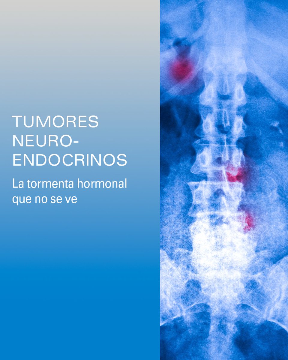 MD Anderson Cancer Center Madrid - Hospiten tweet media