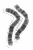 KingOfSalt4's tweet photo. Human Chromosome 2 (Image 1) is evidence that man and chimpanzees share a common ancestor.

As you know, all great apes have 24 pairs of chromosomes, while humans only have 23. Chromosomes are packages of DNA containing genes.
To view all the chromosomes in a cell, scientists use what's called a karyotype which lays them all out to see in matching pairs. By arranging them in order like this, they can see if a person has any missing, extra, or deformed chromosomes.

The light and dark bands are a result of staining, appearing as light or dark depending on how each region absorbs the staining: tightly packed DNA tends to stain darkly, and loose packed stains lighter.
Staining is used to identify chromosomes and locate specific regions or genes. A chromosome has a "waist" (centromere) which divides it into two "arms": a long and a short, labeled Q and P respectively.

      p arm
        |
        |
        ●  ← centromere
        |
        |
        |
      q arm

Now, if you look at Image 2, you'll notice something: Chromosome 2 has the same pattern of banding as Chimp Chromosome 2p and 2q when lined up.

This is evidence of the origin of human chromosome 2: Chromosome Fusion. It's believed that at some point in our evolutionary history, two separate ape chromosomes joined end-to-end, creating a single larger chromosome. 

Another piece of evidence is a vestigial centromere on Chromosome 2 in the location where one would expect to find the second "waist" from the fusion. Having two waists would be unstable, so it's believed that over time, one of them became inactive.

The third piece of evidence is the presence of telomere sequences in the middle of Chromosome 2. Think of telomeres as like "caps" on the ends on chromosomes. If two were to fuse together end to end, you would expect to find these "caps" in the middle, and that is exactly what we find in C2, in the q13 band, far from either end.

"We conclude that the locus cloned in cosmids c8.1 and c29B is the relic of an ancient telomere-telomere fusion and marks the point at which two ancestral ape chromosomes fused to give rise to human chromosome 2." - Jacob W. Ijdo, 'Origin of human chromosome 2: an ancestral telomere-telomere fusion'
