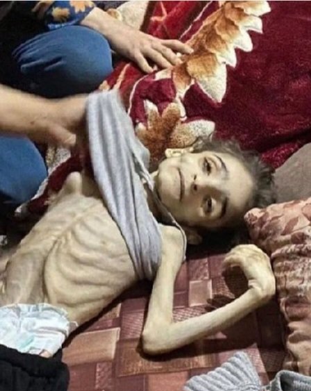ruyaselcuk's tweet photo. Gazze'de çocuklar açlıktan ölüyor...
Vallahi hesabımız çok çetin olacak.

#FreePalestine #GazaGenocide‌ https://t.co/AnWzdJCLPH
