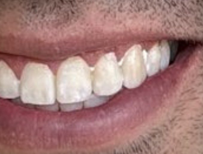 Mabusfer's tweet photo. @Danielbricen Yo creo que mejor empiece a usar más seguido la seda dental respetado ciudadano. https://t.co/nCullnmbWP
