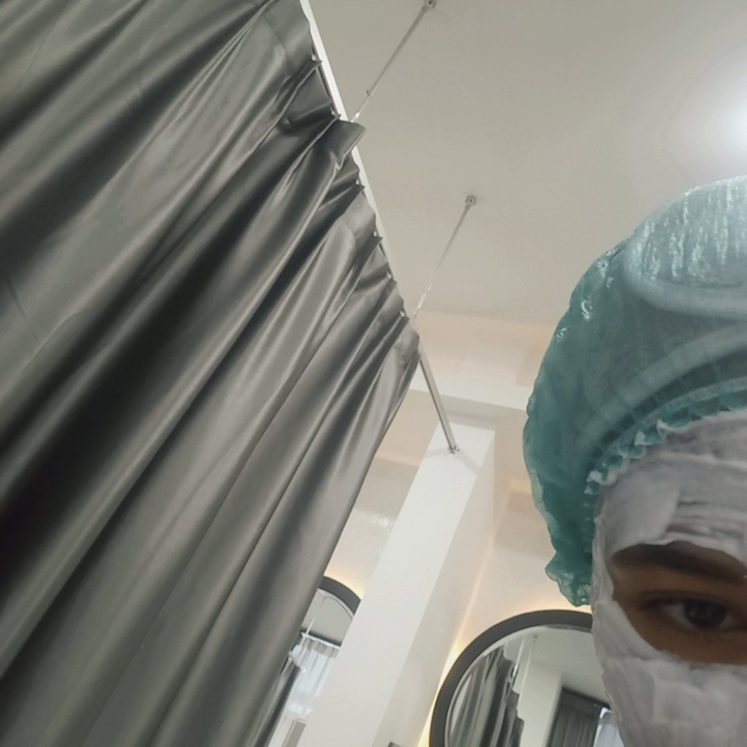 itsgettingcoldd's tweet photo. Pertama kali nyoba treatment, imo pain level Microneedling 8/10. Kalau pas disuntik jarum kecil 9/10, apalg pas deket sama mata itu kan kulitnya tipis sakit bgt plis.

Bener2 beauty is pain selain pain di wajah pain juga di dompet wkwk, but it is okay. The only pain I can accept https://t.co/N2HOOkTuAO