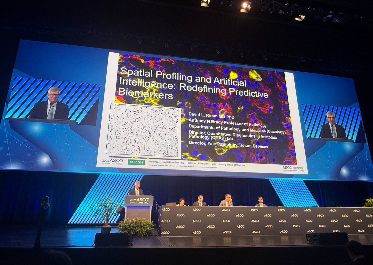 YaleCancer's tweet photo. At #ASCO26, Dr. David Rimm @yalepathology discussed new data suggesting #AI can “read” standard #pathology slides to infer molecular signals that usually require extra lab tests, a potentially faster and more accessible method. Still research, not yet a replacement for today’s validated companion diagnostics. @ASCO @SmilowCancer @OncoAlert
