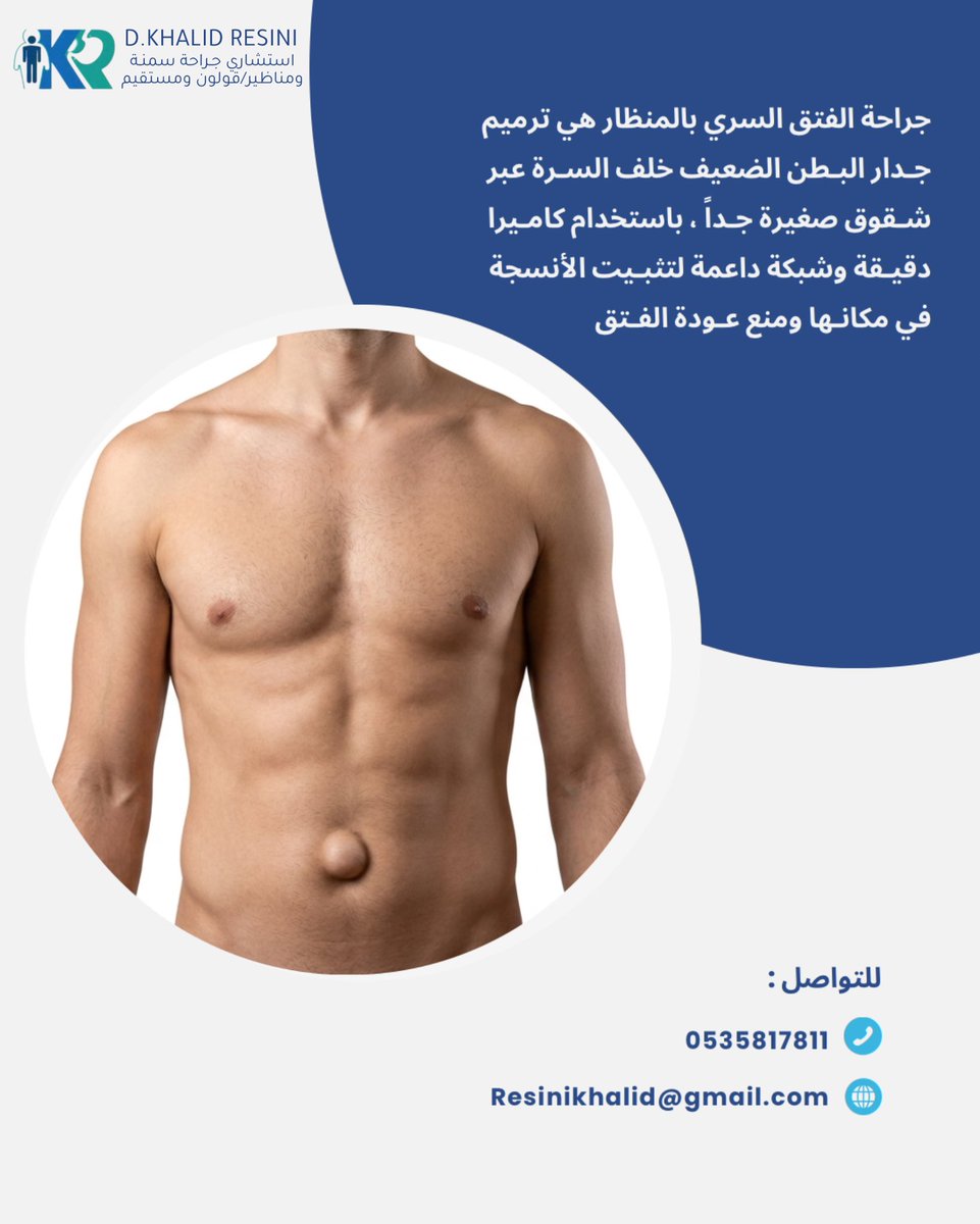 dr_Resini's tweet photo. اصلاح الفتق السري بالمنظار https://t.co/hrabaguF1p