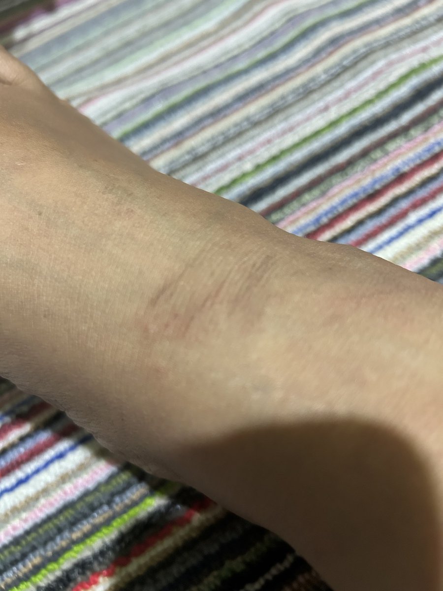 letitflowajasi's tweet photo. nyari daun buat penelitian aj hrus smpe sesakit ini😭😭 https://t.co/vGPiVh0WUP