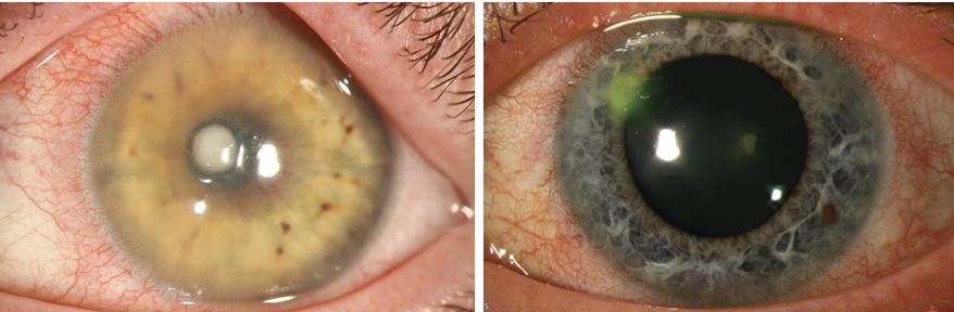 revoptom's tweet photo. The Ocular Surface: An Inflammation War Zone

Follow along as we review the ocular surface’s anatomy, functions and anti-infectious defense mechanisms for a thorough understanding of how it operates: https://t.co/3YCnYJvPi7 🔗

#optometry #optometrist #contactlens #contactlenses https://t.co/e460O6dNfg