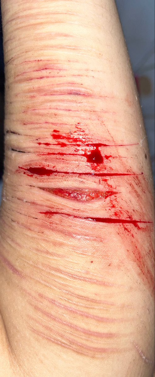 Leonloverwwe's tweet photo. The cut no 3 from the top is actually a baby beans but it closed up idk why #shtwt https://t.co/cO3mvsmW4b