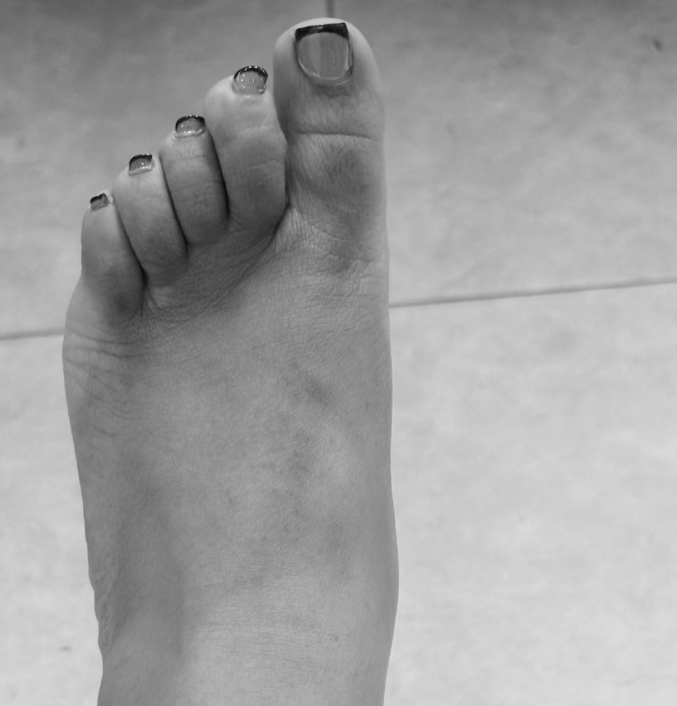 PiggysTen's tweet photo. im selling custom feet pics and videos. 👣😋You don’t want to miss out on this💦Pretty feet, pretty toes, sexy soles. Serious inquires only.  

findom paypig finsub whalesub brat humanatm walletdrain #wrinklesoles  #feetfetısh #feetworshi̇p https://t.co/fbLAeSuOvR