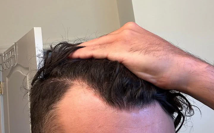 bloo scalp and soap. tweet media
