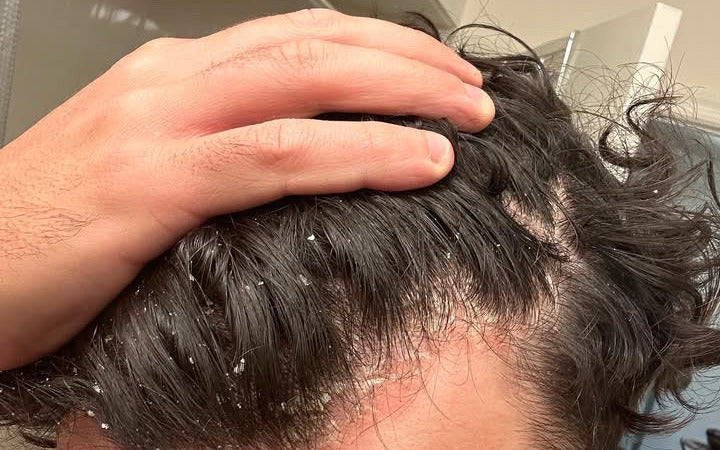 bloo scalp and soap. tweet media