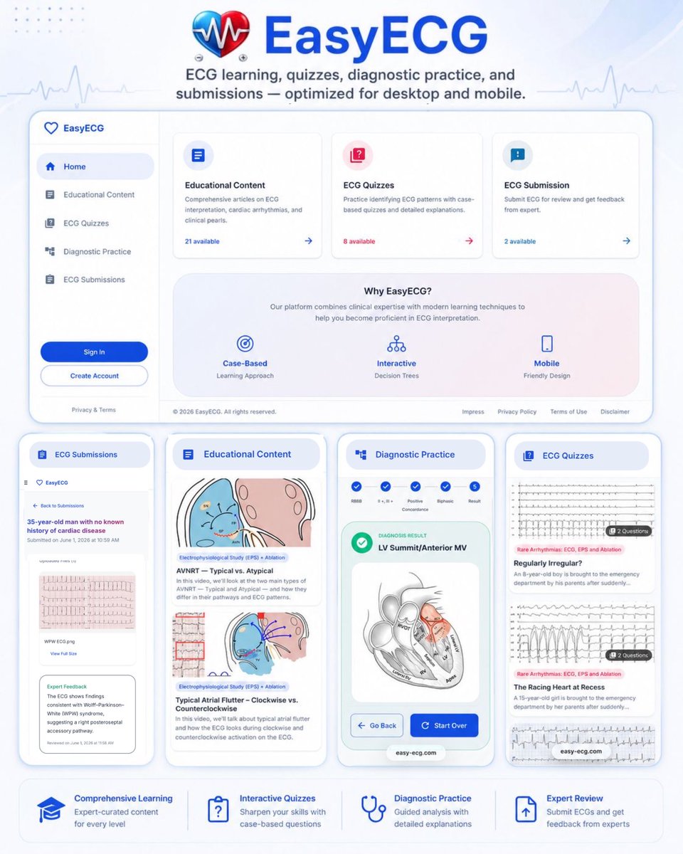 melhamriti's tweet photo. 👇Finaly the beta version of the new Easy-ECG website and Easy-ECG app👇

Over the past months, we have been working on a project aimed at making ECG and electrophysiology learning more accessible and interactive. Today, we are happy to present Version beta of “ https://t.co/mKXgscCGa4 ”

🔹 What’s new?

✅ Easy-PVC and Easy-WPW algorithms:
We have introduced new illustrations and visualizations to support a more intuitive and anatomically guided analysis.

✅ Educational Content
Learn the principles behind both algorithms to deepen your understanding and strengthen independent ECG interpretation. The platform also includes educational articles, videos, and arrhythmia-focused learning resources that can be filtered by topic.

✅ ECG Quizzes
Interactive ECG cases with structured questions and detailed explanations provide an engaging way to reinforce learning.

✅ ECG Submission – one of my favorite!
Users can anonymously upload ECGs, which @N_Trajkovska  and I will personally review and interpret through the app.

⚠️ This is not AI-generated interpretation and not a clinical reporting service. All responses are human-generated and intended exclusively for educational purposes.

This is still an early version, and there is much more to improve and develop. We have several ideas and features planned as we continue building an EP e-learning platform for all of US.

💡 We would greatly appreciate your feedback and constructive criticism. Your suggestions will help us improve the platform.

📱 The iOS and Android apps are currently in testing and will be available soon.

❤️ The platform will remain completely free, because we believe that knowledge should be shared and accessible to everyone.

Thank you for your support.

@Phiso_de @ecgrhythms @ecgandrhythmRoe @ECGEPSCADEVICE @Ecgloverr @KostekMilan @chris_sohns @ArashArya_EP @MoneebKhalaph @MBraunEP @Teebi_MD @MattersoftheH14 @Mo_PedsEP @Koichi16423232 @mameeps @ALFIEEP1 @enes_elvin @narrowQRS @KardiologieHH @YoungDgk @ChristianHeeger 
#ECG #Cardiology #Electrophysiology #MedicalEducation #FOAMed #Arrhythmia #DigitalHealth #EasyECG #EPeeps
