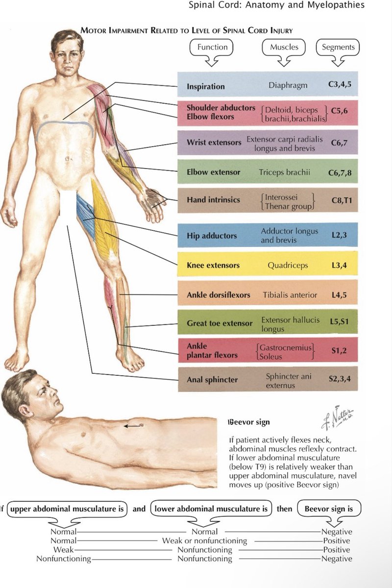 OGdukeneurosurg's tweet photo. Nerve and muscle  control  by levels https://t.co/tHdeuVjzbU