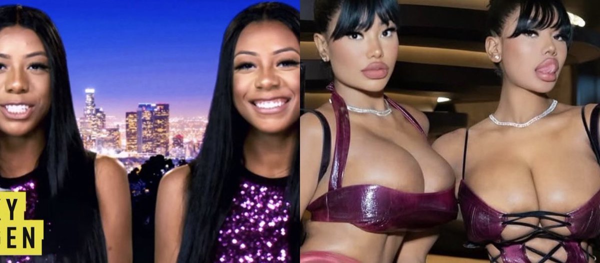 spicebae_'s tweet photo. if you gone get plastic surgery, make sure it's TEA 🤏🏾 https://t.co/Qly9ZDWk6E