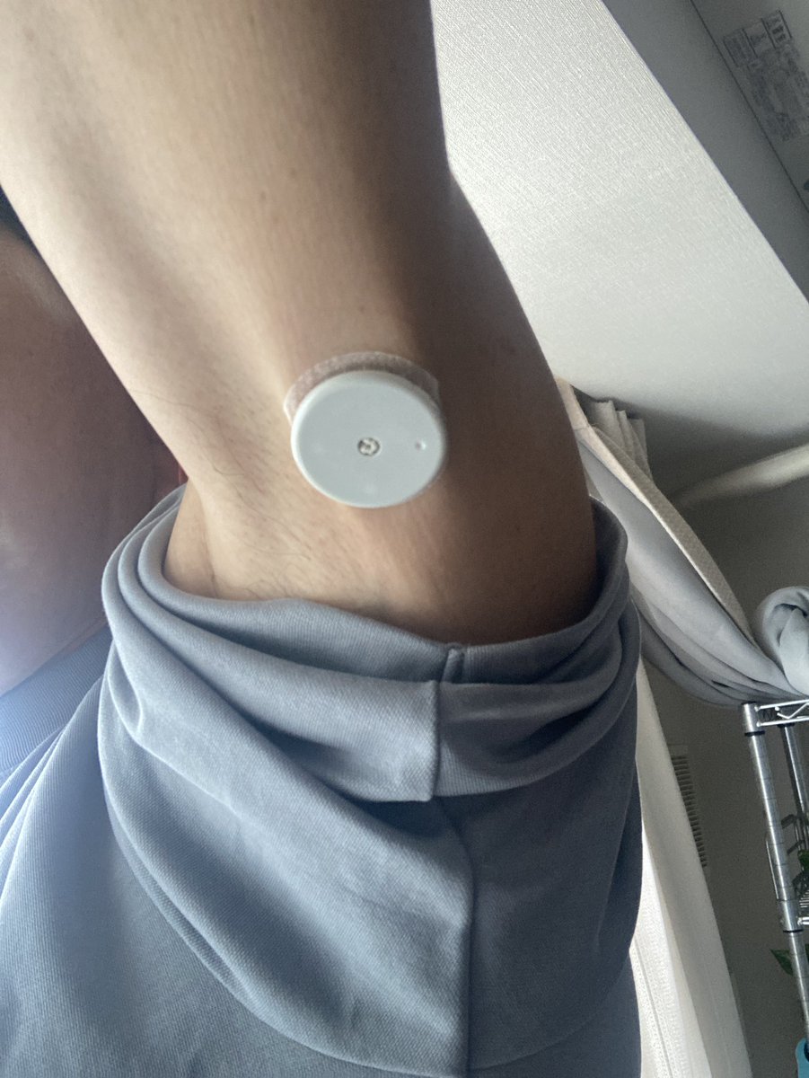 post_blackjack's tweet photo. 清水ヶ丘
リハビリ&amp;ダイエットジョグ
Hyper speed4
3日連続でも問題なさそうなので後半ペースアップしたらむしろ身体に合う速度帯😆
と思ったらやはりまだしびれが😅
奥信濃完走に向けて、血糖値センサー装着🔥
#リブレ
#sympafit
#血糖値ランナー https://t.co/JIQ85D1ZL4