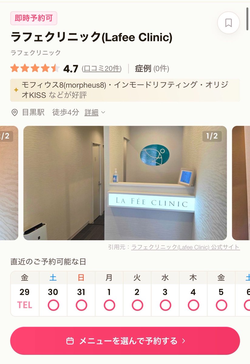_____noay's tweet photo. ルメッカやりたくて色々探してたら、ラフェクリニックのキレイレポ限定キャンペーン発見👀
通常よりかなりお得で、ルメッカが5,000円で受けられるらしい🥹✨
7月末までみたいだから気になる人は早めがおすすめ！
他にもお得な施術たくさんあったので、キレイレポ見てみて🙌
#PR https://t.co/TTE9vNpgpg