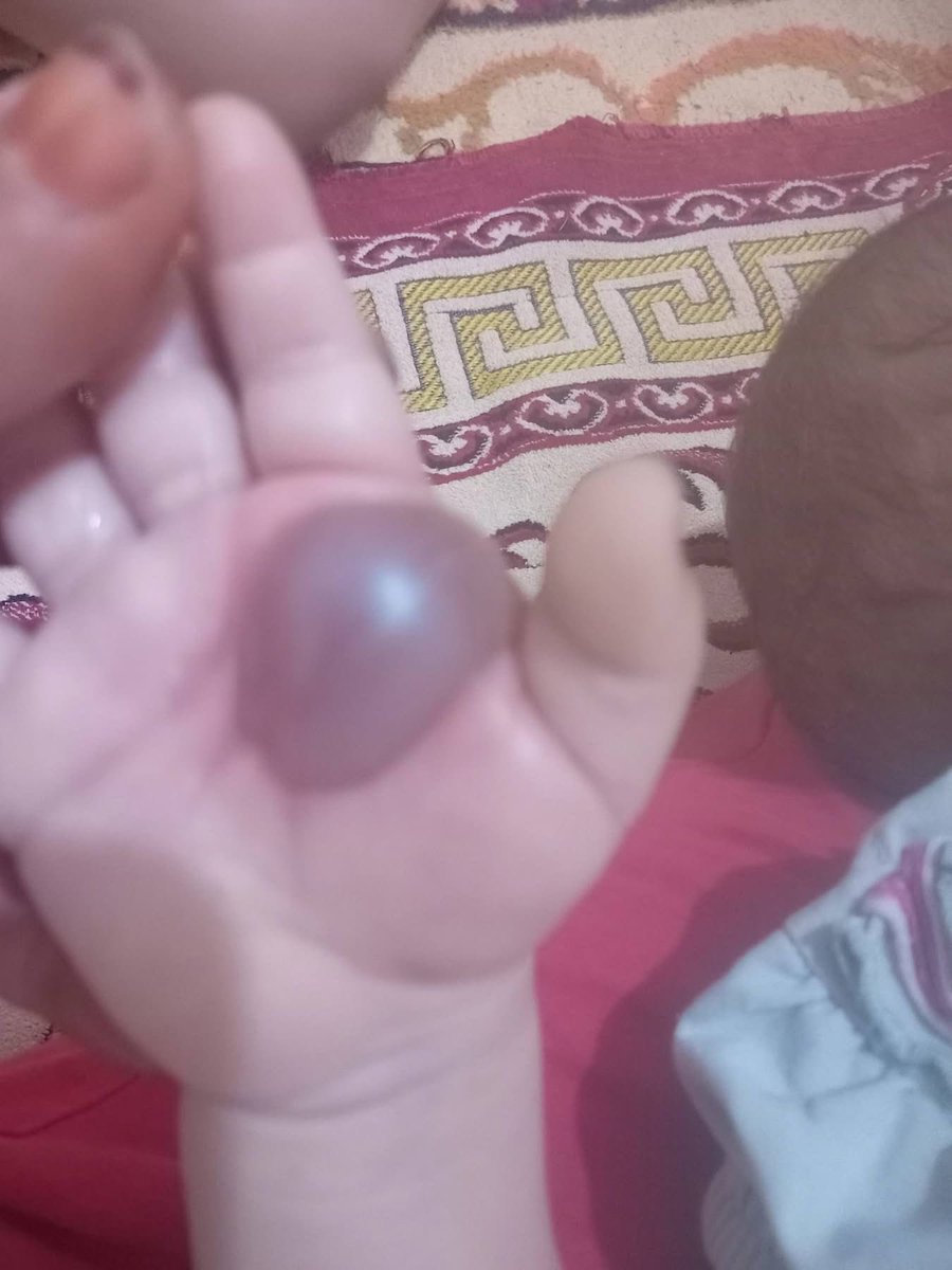 Dr_SaebGaza's tweet photo. My little girl's hand was burned She is in a lot of pain Treat her like your daughter and help her. 😫😭

Donate $10 

https://t.co/d015UU6KQ4 https://t.co/OHzmAIa0AO