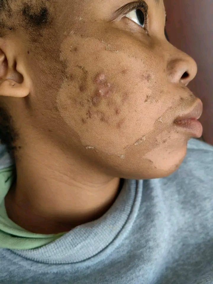 Nkizo's tweet photo. Algae Peel Special for ONLY R650! 🌿💆🏽‍♀️

✅ Improve skin texture
✅ Reduce acne scars and blemishes
✅ Brighten dull skin
✅ Promote a smoother, healthier complexion

⏳ Valid until 7 June 2026

📲 WhatsApp: 067 273 0687
📍 Pretoria Central

#BrutallyBeautiful l #BlessedTuesday https://t.co/DAoPILOgnp