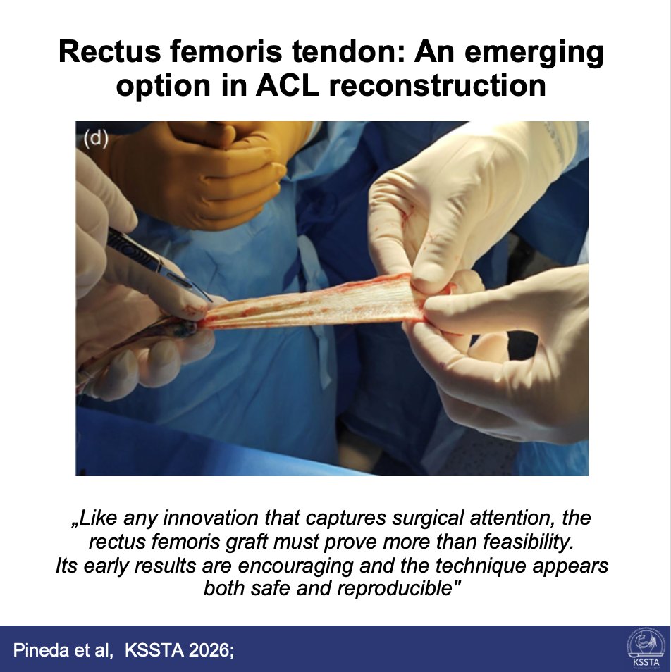 KSSTA's tweet photo. The rectus femoris tendon is gaining attention as a versatile autograft option for ACL reconstruction, offering predictable dimensions, low donor-site morbidity, and sufficient length for combined ligament procedures using a single harvest.

Read here: https://t.co/ZXxjc9vuLK https://t.co/OPEW7QUlJR