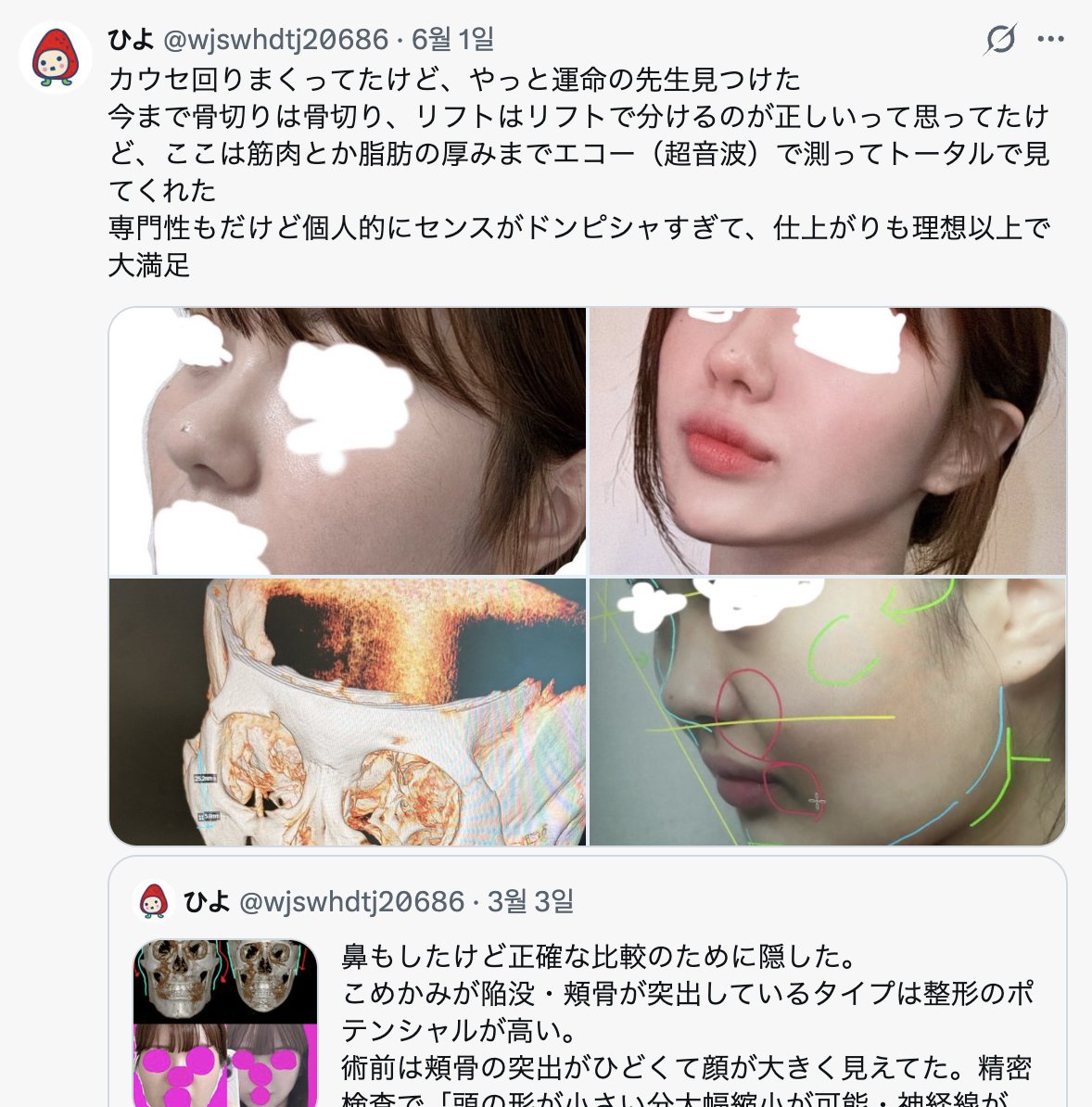 LaraLa_review's tweet photo. 病院が患者のフリして投稿するのは自分の中ではアウト…😰

公式垢で症例載せればいいのに、わざわざ一般患者の口コミみたいに見せるのは騙してるのと変わらない気がする。 https://t.co/nrlz7Ilwed