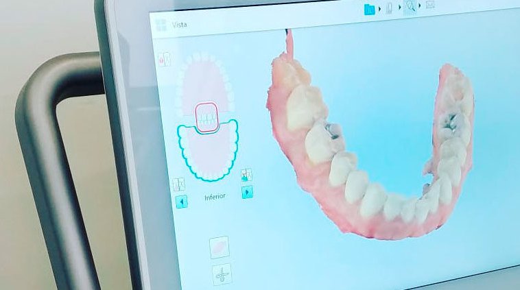 Lab3dHulp's tweet photo. 🧩Inteligencia artificial, diagnóstico 3D y alineadores, vía @gacetadental 

⚓️https://t.co/UKgoZj7iCA

#Lab3DHulp #MAXILOLAPAZ #Bioimpresion3D #Planificacion3D #FabricacionAditiva #CirugíaNavegada #ComputaciónCuántica #RealidadAumentada #Algoritmos #Qubits #IoT https://t.co/yl89d9OrDL