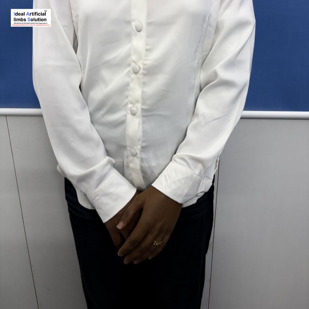 tezan_kumar's tweet photo. 🌸 Confidence has no limits, and neither should your dreams. 🌸

Our custom-made **Silicone Hand Prosthesis** is designed to provide a natural appearance, comfort, and renewed confidence for women who have experienced hand loss.
#SiliconeHandProsthesis #ArtificialHand https://t.co/36U8sesyjr