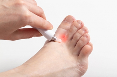 PalosPodiatry's tweet photo. Blisters and Skin Irritation From Athlete’s Foot https://t.co/Pqe2Vtqzii https://t.co/mGjjObLAl3