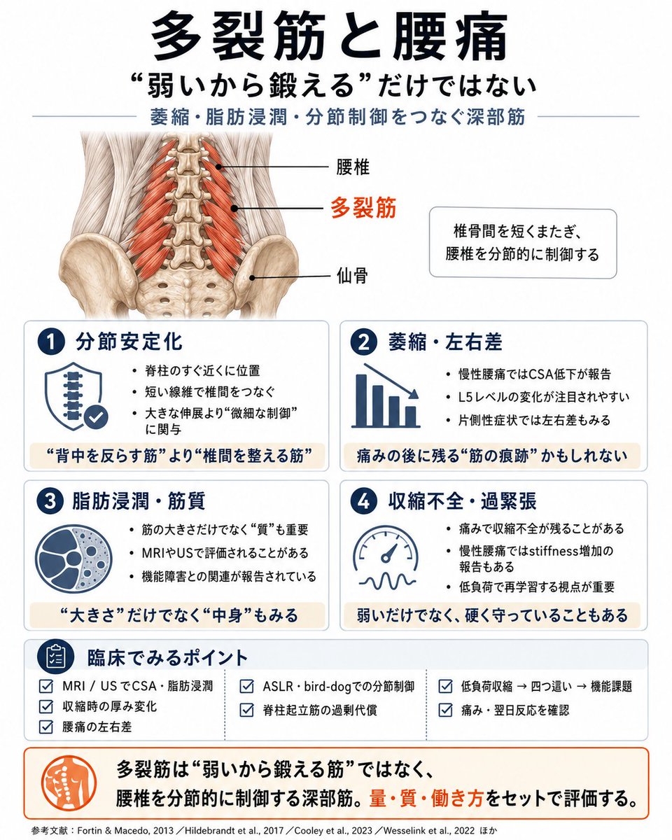 physio_17's tweet photo. 多裂筋と腰痛の関係

多裂筋の役割として腰椎を分節的に制御することだと思います
この筋の機能不全は腰椎の不安定性に関与し、結果的に腰痛に影響する可能性がある https://t.co/L4K9UAlFtS
