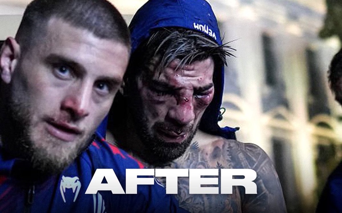 HaterReport's tweet photo. Ilia Topuria’s face before and after fighting Justin Gaethje 😳😳 https://t.co/tsWgNRl6jz