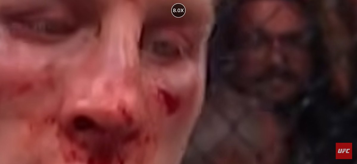 Peacefv's tweet photo. Quien diga que tener la cara así después de un primer round por golpes simplemente es un enfermo de la cabeza , hasta acá se ven las uñas enterradas, @Justin_Gaethje como después de picarle los ojos y tenerlo inválido en el 4to round sigue tirándote y haciéndote guerra 🤣 🤣🤣 https://t.co/p3aQYUyu6U