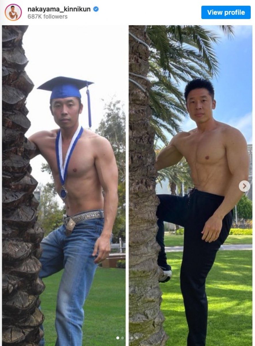 MiTON_mitochon's tweet photo. 40代後半にして20代のような肌ツヤと肉体を誇る、なかやまきんに君。

彼の「老けない理由」を、分子栄養学と細胞レベル（ミトコンドリア）の視点でガチ考察してみました。

彼は特別な高級美容液を使っているわけではありません。

実践しているのは、体内環境を最適化し、細胞を根底から再起動（リブート）させる最強のルーティンです。

アンチエイジングの真髄が詰まった「5つの大原則」を解説します👇

✅ ① 年間の7割を固定する「超・抗糖化」食

彼の食事は鶏むね肉やブロッコリーを「茹でる」のが基本。

ここが最大のポイントです。

「焼く・揚げる」といった高温調理は、細胞を焦げつかせる老化物質AGEs（終末糖化産物）を大量に発生させます。

AGEsは、私たちの細胞内にあるエネルギー工場「ミトコンドリア」の働きを阻害し、ATP（生体エネルギー）の生産を低下させる大敵。

徹底して「水」を使った調理にこだわることで、細胞レベルの酸化と糖化を防ぎ、常にエネルギーに満ちたクリアな体を維持しているのです。

✅ ② 朝イチの「白湯＋プロテイン」による異化ブロック

起床時は、長時間の絶食により体がエネルギー不足に陥り、自らの筋肉を分解（カタボリック）してエネルギーを作ろうとする危険な時間帯です。

彼は朝一番に白湯で胃腸を目覚めさせ、直後にプロテインを流し込みます。

これにより最速で血中にアミノ酸を届け、筋肉の分解をストップ。

細胞の修復と新陳代謝に必要な材料を確実に供給する、完璧なスタートダッシュです。

✅ ③ 筋肉を「最強の内分泌器官」として育てる

彼の筋肉は、単なる見栄えのためではありません。筋肉が収縮するとき、そこからは「マイオカイン」と呼ばれる若返りホルモンが分泌されます。

このマイオカインは血液に乗って全身を巡り、脂肪燃焼を促すだけでなく、肌の弾力向上や全身の抗炎症作用をもたらします。

さらに、適切な筋トレは「ミトコンドリアの新生（細胞内での増殖と活性化）」を強烈にプッシュします。

彼の肉体は、自ら若返り成分を作り出し、細胞のエネルギー代謝を回し続ける「自家製のアンチエイジングプラント」なのです。

✅ ④ ギャグに隠された「表情筋のATP消費」

「パワー！」「ヤー！」というお馴染みのギャグ。

半分冗談に聞こえるかもしれませんが、実は理にかなっています。

大胸筋を力強く収縮させながら叫ぶことで、首の広頸筋（こうけいきん）や目の周りの眼輪筋が強く刺激されます。

顔の筋肉もミトコンドリアでATPを消費して動いています。

日常的に表情筋をフル稼働させることで、顔周りの毛細血管まで血流が促進され、結果的に表情筋の良いトレーニングとして機能し、細胞への栄養供給を後押ししているのかもしれません。

⑤ 決断疲れをなくす「ブロッコリー・マインド」

食事を固定化する裏のメリットは「今日何を食べよう？」という日々の決断疲れ（ウィルパワーの浪費）を防ぐこと。

精神的なストレスはコルチゾールを過剰分泌させ、細胞内に酸化ストレスを生み出し、ミトコンドリアの機能を低下させます（＝細胞の老化）。

「今日もブロッコリーを食べられた自分はエライ」と小さな積み重ねを肯定する彼のメンタルは、ストレスによる細胞へのダメージを完璧にブロックしています。

💡まとめ

きんに君の若さは、奇跡ではなく「必然」です。

1. AGEsを避けてミトコンドリアを守る
2. アミノ酸を絶やさず細胞を修復する
3. 筋肉から若返りホルモンを出す
4. 表情筋まで使い切る
5. ストレスを排除して細胞を休ませる

高価なサプリや美容医療に頼る前に、まずは細胞が喜ぶ当たり前の習慣から。

今日からできる「細胞リブート習慣」、ぜひ一つでも取り入れてみてください！

パワー！💪✨
