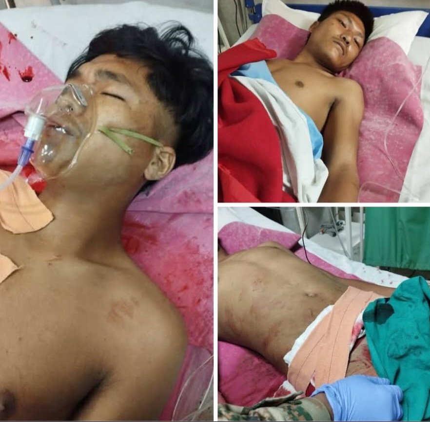 BaiteLulun's tweet photo. The 3 kuki_zo Leilon village boys injured from the attack of combine tangkhul nscn &amp; zuf militants were rush by meitei &amp; liangmai crowd at hospital to kill. separate administration UT for kuki_zo the only solution. #PMOIndia #Amitshah #rastrapatibhavan #supremecourt #digofIndia https://t.co/nKgVDjDV4r