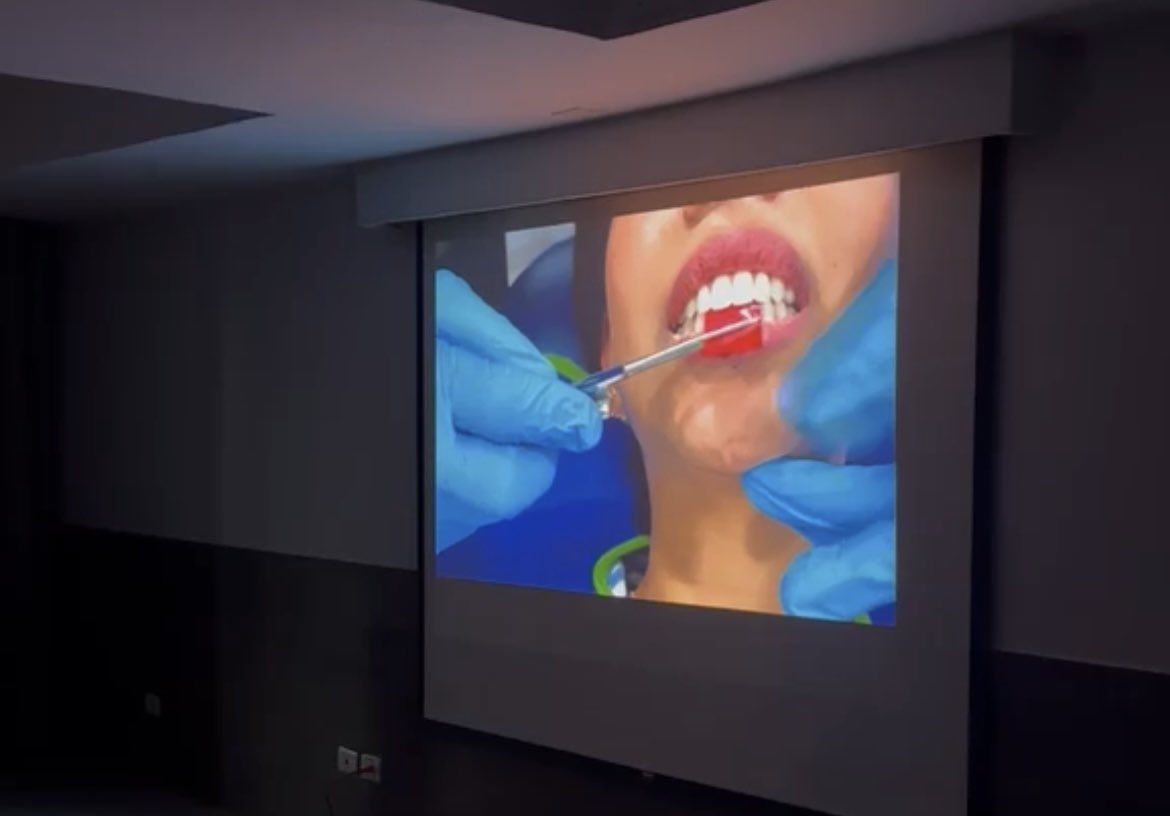 BauschTurkey's tweet photo. Presentation Dr. González 🇲🇽 in Villahermosa, Tabasco.
I ❤️ OccluSense
I ❤️ Bausch https://t.co/cvP0D1KQc8