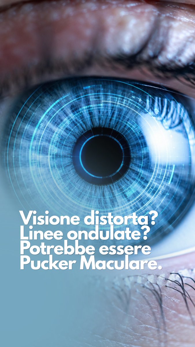albertobellone's tweet photo. Vedere le linee distorte o i volti alterati non è una condanna a cui rassegnarsi.

🔍 Il Pucker Maculare si risolve efficacemente grazie alla microchirurgia mininvasiva 27G.

🔗 https://t.co/DYrC0ei1Jb https://t.co/75K9zC43kw