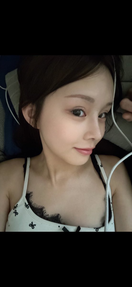 2003__mm's tweet photo. FINTで鼻の施術をしてきました！一番のコンプレックスだった鼻の陥没感を、顔のバランスに合わせて自然に改善してくれました😭 先生が安心できるのはもちろん、通訳さんがとっても綺麗で優しくて心強かったです🥹 まだダウンタイム中だけど、今のところいい感じです🫶 https://t.co/PT7td1cUlU