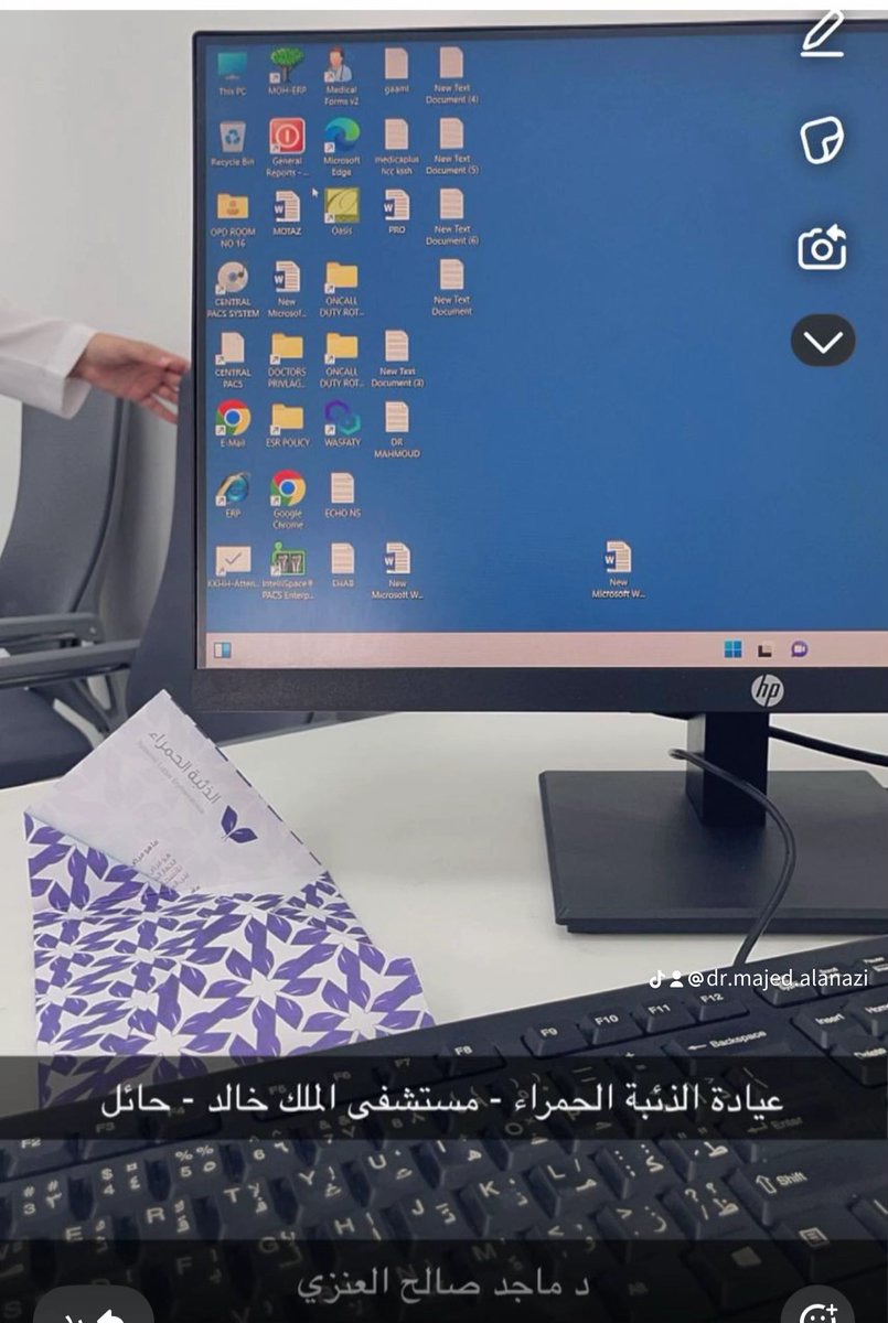 DrAlenazi's tweet photo. أفتخر بأن أذك أنه بعد عامين من العمل الدؤوب عقب إتمام زمالتي في علاج الذئبة الحمراء في مستشفى تورنتو ويسترن بكندا، نجحتُ في تأسيس عيادة متخصصة في علاج الذئبة الحمراء في مستشفى الملك خالد بحائل. إضافةً إلى ذلك، أنشأتُ عيادة مشتركة لأمراض الروماتيزم والكلى لتوفير رعاية شاملة لهم . https://t.co/BJnrQciTri