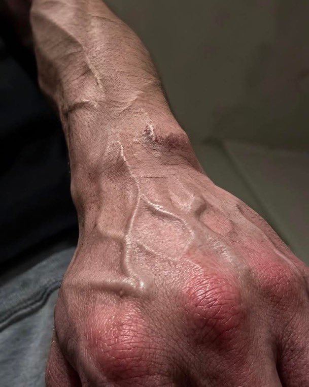 hop_core's tweet photo. Hey @grok what can be the reason for my boyfriend’s hand being like this ? 😨 https://t.co/fC4QBMo9MG
