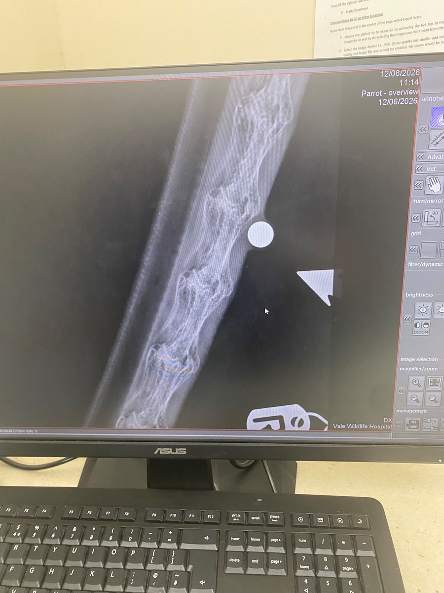 wildliferescuer's tweet photo. A lump on the neck. That's all the initial report said 💔 .

When this swan arrived with us, our veterinary team began investigating the cause of the swelling. Sadly, the answer was all too familiar.

An X-ray revealed a pellet embedded in her neck.

Someone, somewhere, had fired a catapult or similar weapon at this legally protected bird. The pellet narrowly missed causing catastrophic injuries, and she was incredibly lucky to survive.

This is exactly why we work alongside Naturewatch Foundation as part of their **Target Crime, Not Wildlife** campaign. Every year, we see the devastating consequences of wildlife persecution, with animals injured, maimed and killed by weapons that are far too easily obtained and used against wildlife.

For this swan, the outcome could have been very different.

Instead of spending this time of year out on the water, potentially preparing to raise a family of her own, she is recovering in a hospital enclosure because of a completely preventable act of cruelty.

No wild animal should have to endure this.

Please join us in supporting calls for stronger legislation around the sale and possession of catapults and other weapons commonly used to harm wildlife.

Together, we can help ensure fewer animals suffer injuries like this in the future.

Find out more at https://t.co/VOk4f4Qv1s