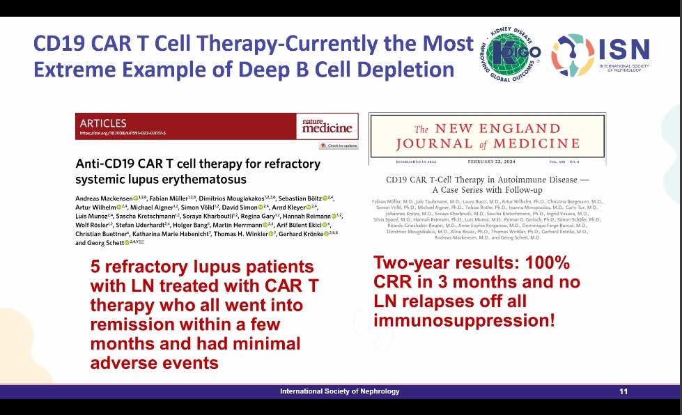 Sandyrvsdav's tweet photo. @ISNeducation @ISNkidneycare @KajareeG @krithicism @myadla @BradRovin CD19 CAR-T may represent the ultimate form of B-cell depletion

Showed success in early studies of refractory SLE/LN

Eliminating not just peripheral B cells but also tissue-resident B cells and germinal centers may be the 🔑 https://t.co/rutJwJoIHt