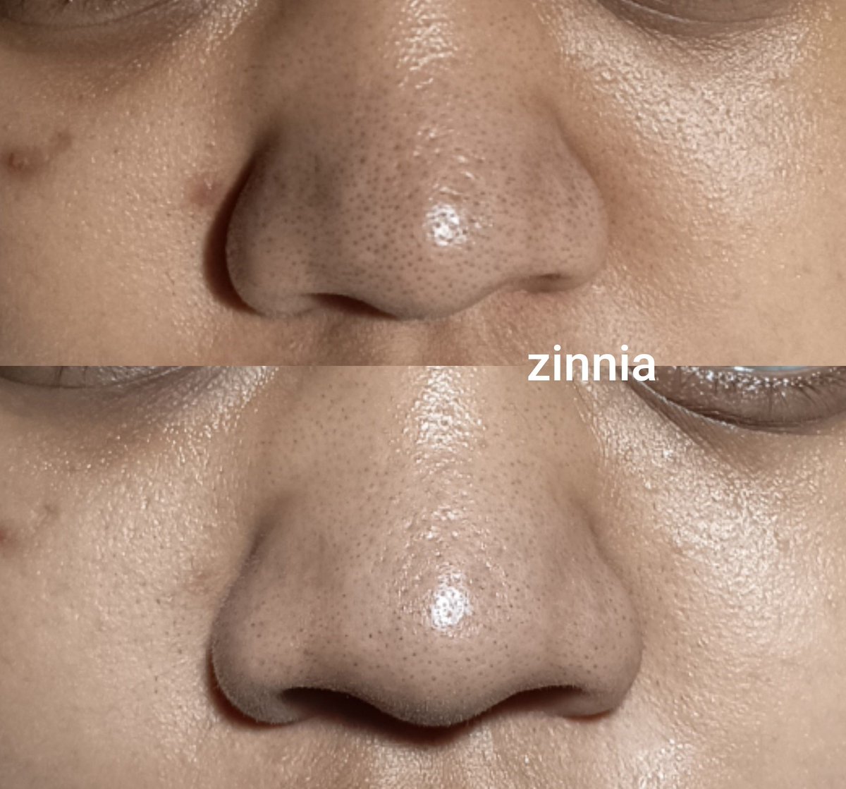 Zinnia tweet media