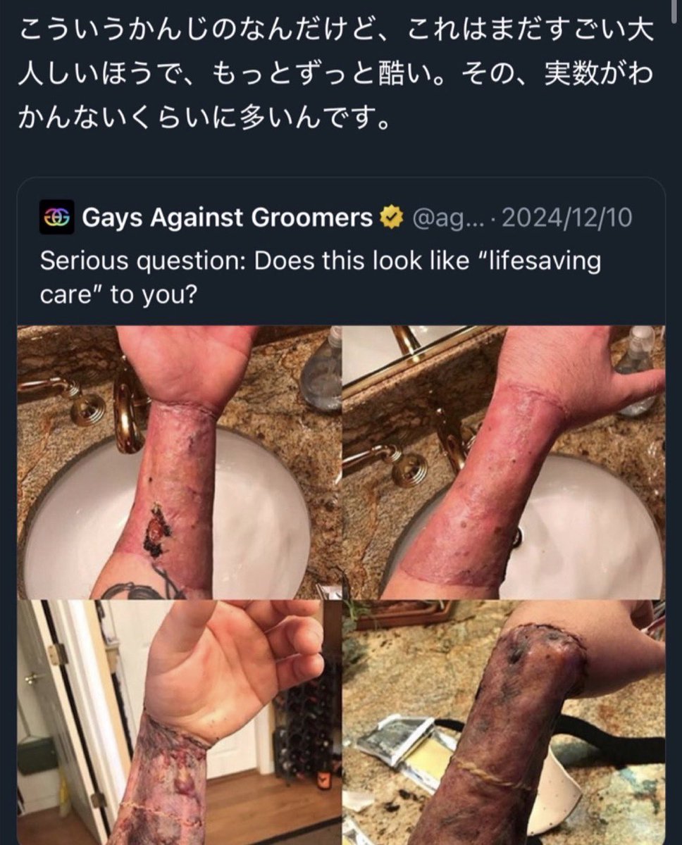 tempalayer's tweet photo. シスジェンダーってなんですか？

欧米の混乱を日本に持ち込むな！ https://t.co/q0BXuyJvLm