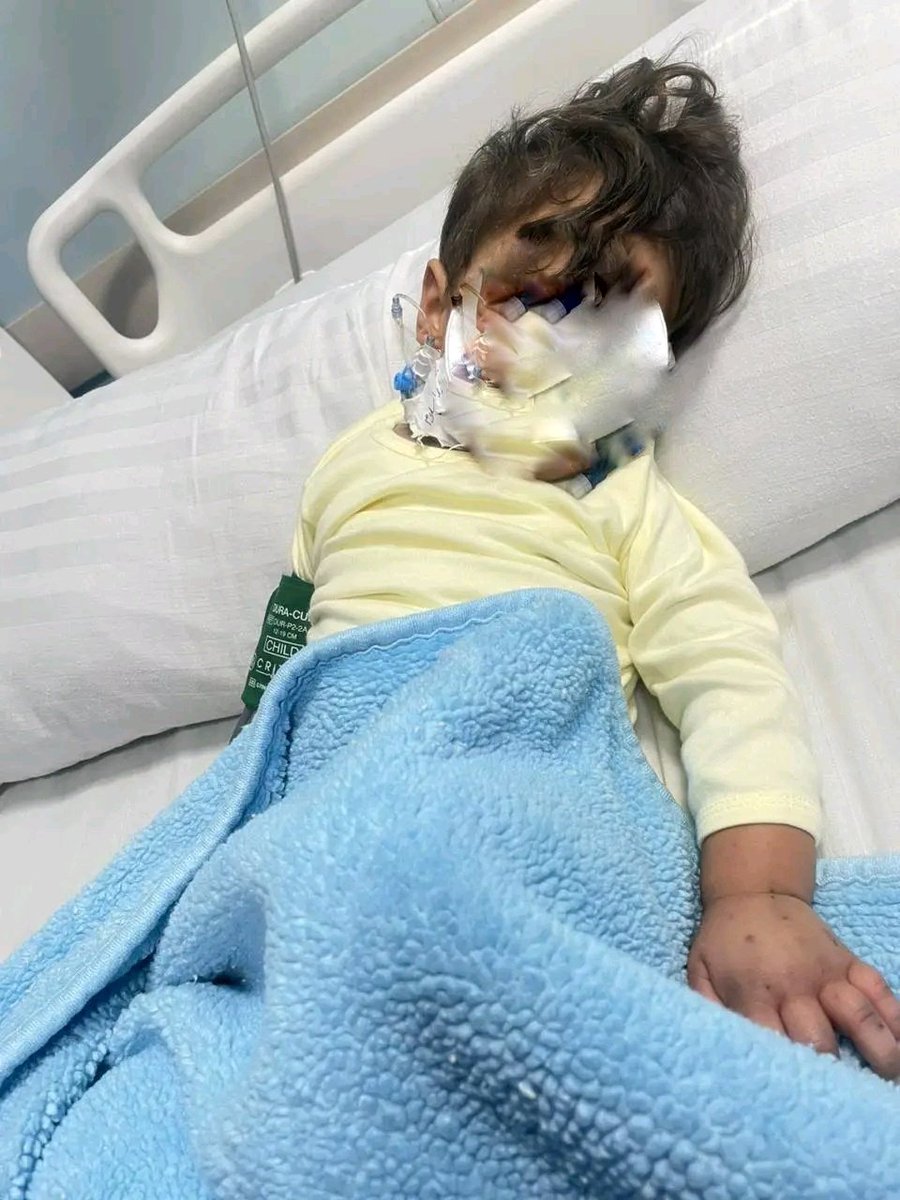 taltol20's tweet photo. ريتويت فضلاً الدال على الخير كفاعله 
محمد سنة و8 أشهر مصاب بتكسير في الدم وبيغسل كلى 3 مرات أسبوعيًا محجوز في العناية المركزة محتاج جرعة علاج بيولوجي عاجلة بـ 50 ألف ج والدته صرفت كل ما عندها والعلاج على نفقة الدولة هيتقرر الشهر الجاي كل جنيه يفرق 01068837579
#السعودية_الأوروغواي #مصر_بلجيكا
#كاس_العالم_٢٠٢٦