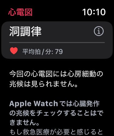 tkkuu's tweet photo. 座ってるのに平均心拍が80近い🤣🤣🤣
小心者過ぎる🤣🤣🤣 https://t.co/dHMOPREIyS