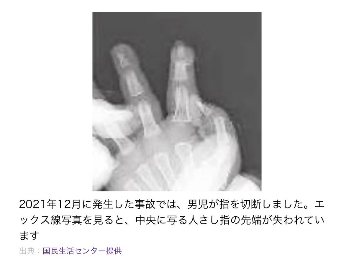 Ortho_FL's tweet photo. これは過去に何件も乳幼児が指を挟み切断に至っているので、消費者庁が何年も前から注意喚起していることは知っておいた方が良い

✔︎乳幼児に触れさせない
✔︎可動部がない踏み台を選ぶことも検討
✔︎大人も指には気をつけよう https://t.co/q6ms4OtATg