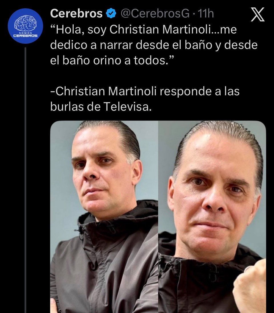 SoySimpsonito's tweet photo. ¡Ese Martinoli te bailó sabroso! https://t.co/aES7jwylBW