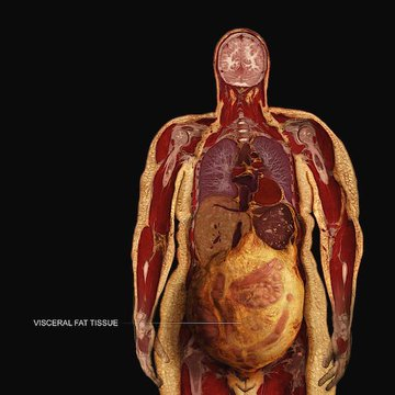 senor_de64605's tweet photo. Conoce al médico número uno del mundo en el tratamiento de grasa visceral.

Dr. Sean O'Mara.

Ha dedicado décadas a investigar cómo este asesino silencioso envenena nuestro organismo.

Estas son sus 7 reglas clave para eliminar la grasa visceral:

1. Come más carne https://t.co/YApzEBwdt5