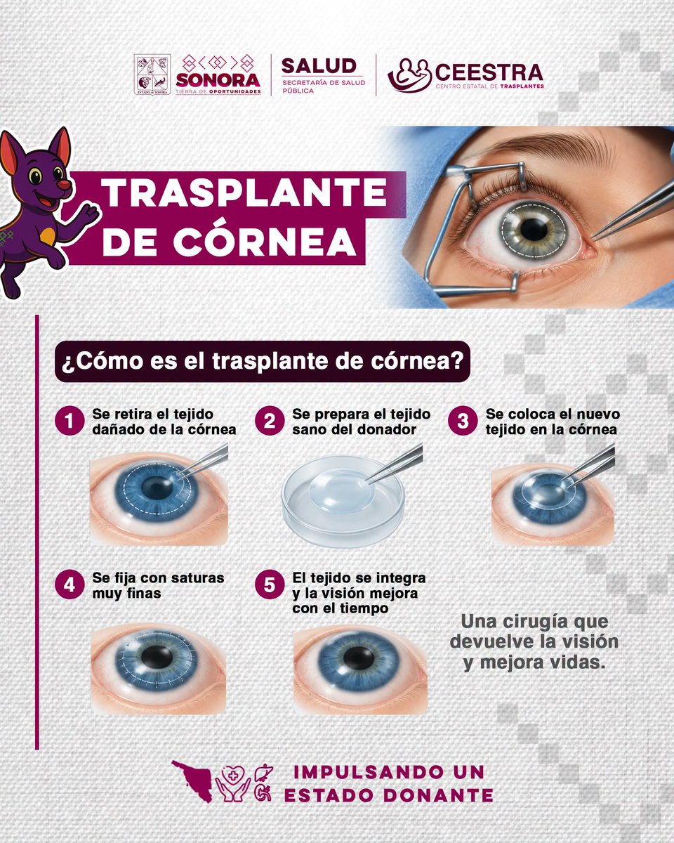 ceestrason's tweet photo. 👁️✨¿Sabías que el trasplante de córnea consiste en reemplazar el tejido dañado por una córnea sana proveniente de una persona donante?

🌵 El @gobiernosonora, bajo el liderazgo del Gobernador @AlfonsoDurazo, continúa fortaleciendo la cultura de la donación.

#SaludSonora https://t.co/gwneuUulGg