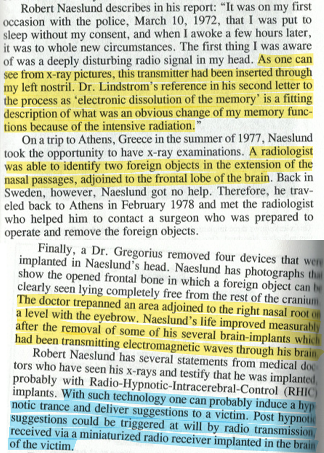 toxictiramisu's tweet photo. Robert Naeslund was implanted w/ a bio-telemetric device in a Swedish hospital. After an altercation w/ police, he was put to sleep w/o consent &amp; awoke to a strange radio-like sound in his head. X-rays revealed foreign objects in his brain, causing memory loss/behavioral changes. https://t.co/rcPcJzHUNn