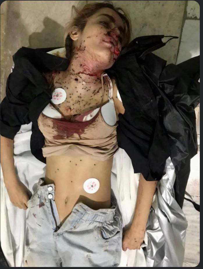 TIDINY's tweet photo. @MOSSADil Criminal and thieving regime, a few months ago, they murdered thousands of teenagers.
Poor people of Iran https://t.co/whtbPoo8dF