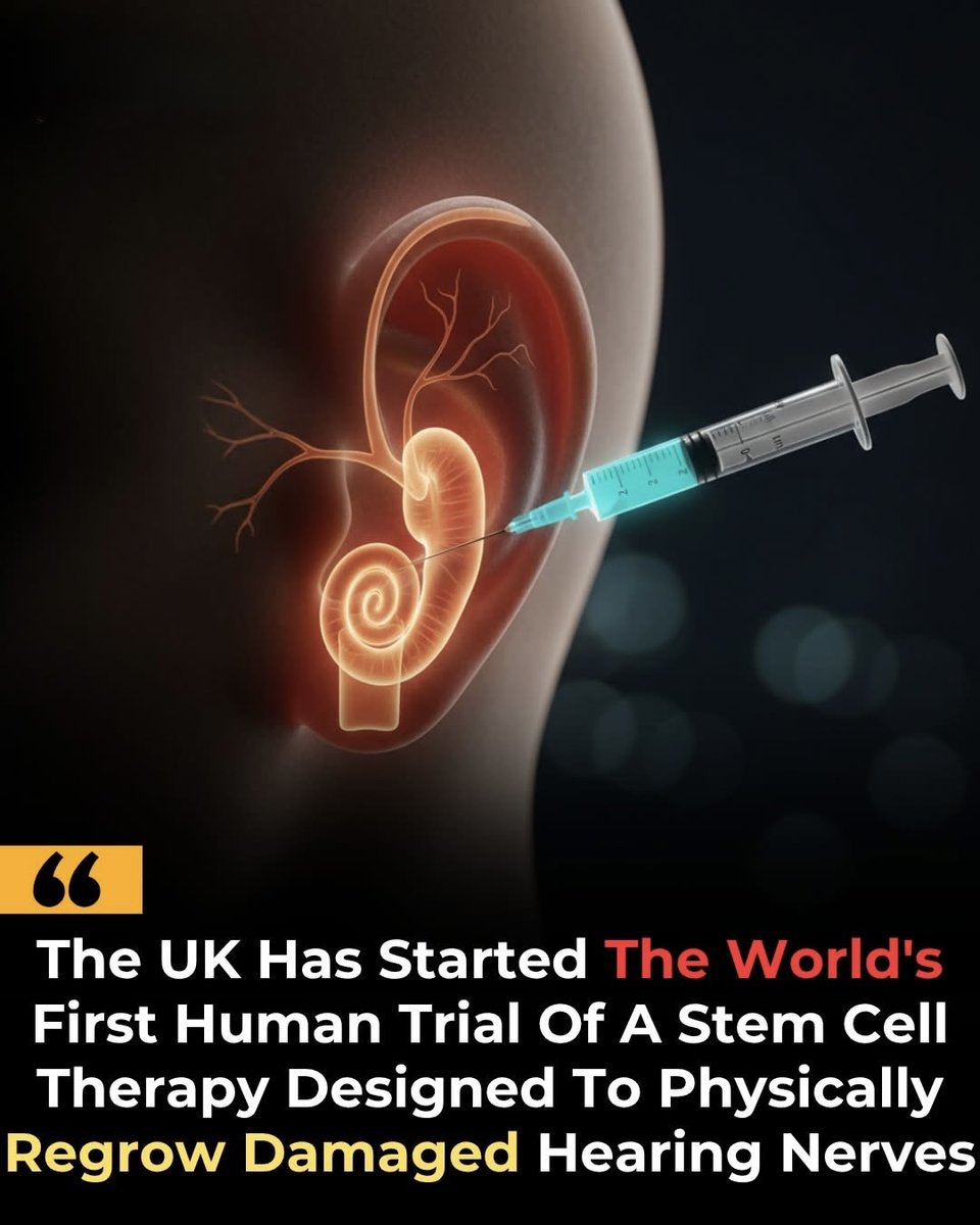 NextScience's tweet photo. 🚨 They May Be Rebuilding Hearing, Not Just Repairing It

A UK-based company, Rinri Therapeutics, has launched the first human trial of a stem cell therapy called Rincell-1. Unlike traditional hearing aids that only amplify sound, this approach aims to regrow damaged auditory neurons inside the inner ear.

The trial will test the therapy on 20 cochlear implant patients, with early results expected within a year. If successful, it could move hearing treatment from symptom control to actual biological repair, potentially helping millions worldwide who live with neural hearing loss.

Source:
Rinri Therapeutics. (n.d.). Rincell-1 clinical trial announcement. Official company release.